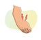 Twisted Foot- Ankle Sprain - Illustration