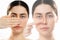 Two faces of young caucasian woman cover her nose with hand and point at her crooked bridge of the nose. Isolated on