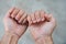 Two young man hands with ugly and bitten fingernails