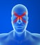 Type headache: Sinus