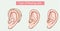 Type of hearing aids