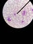 Type of white blood cell (Leukocytes) : Neutrophils