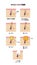 Types of acne illustration set   / Japanese