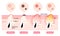 Types of acne illustration. white head,black head, papules, and pustules. Beauty skin care concept