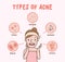 Types of acne with woman cartoon illustration vector on pink background. Beauty concept.