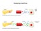 Types of diabetes mellitus