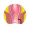 Types of fistulas of the rectum. Paraproctitis. Anus. Abscess of the rectum. Infographics. Vector illustration