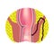 Types of fistulas of the rectum. Paraproctitis. Anus. Abscess of the rectum. Infographics. Vector illustration