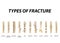 Types of fracture. Fracture bone set. Infographics. Vector illustration on isolated background.