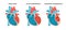 Types of heart diseases - normal, hypertrophic and dilated cardiomyopathy. Human heart muscle diseases cross-section.