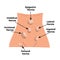 Types of hernia. Epigastric, Lateral, Umbilical, Inguinal, femoral, incisional hernia. intestinal hernia. Infographics. Vector