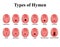 Types of hymen. Imperforate, annular, Denticular, Cribriform, dentate, Crescentic, Labial, Fimbriated, Septate, lunar