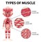 Types of muscle cell diagram