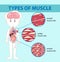 Types of muscle cell diagram