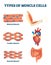 Types of muscle cells vector illustration. Labeled soft tissues explanation