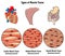 Types of Muscle Tissue of Human Body Diagram