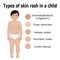 Types of skin rash in a child