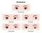 Types of strabismus vector illustration