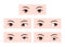 Types of strabismus vector illustration