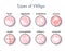 Types of vitiligo infographic icons Options for the spread and manifestation of the skin disease.