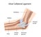 Ulnar collateral ligament of elbow