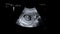 Ultrasonography of Baby in mother`s womb. Ultrasound of baby body and spine. Tiny baby is turning in mother`s belly. 12