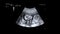 Ultrasonography of Baby in mother`s womb. Ultrasound of baby body and spine. Tiny baby is turning in mother`s belly. 16