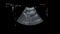 Ultrasonography of pregnant woman. Ultrasound of baby body and spine. Tiny baby is turning in mother`s belly. 32 weeks