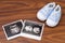 Ultrasonography and sneakers