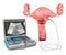 Ultrasonography of the uterus or transvaginal ultrasound concept. Uterus with medical ultrasound diagnostic machine, 3D rendering