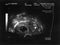 Ultrasound fetus portrait