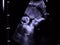 Ultrasound image of baby`s face profile with a heartbeat and tiny hand moving - 36 weeks, 9 months pregnant