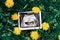 Ultrasound image pregnant baby photo. Ultrasound pregnancy picture on grass flowers background. Concept of pregnancy