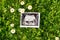 Ultrasound image pregnant baby photo. Ultrasound pregnancy picture on grass flowers background. Concept of pregnancy