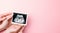 Ultrasound image pregnant baby photo. Woman hands holding ultrasound pregnancy picture on pink background. Pregnancy