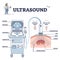 Ultrasound patient analysis process and equipment explanation outline diagram