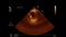 Ultrasound transesophageal examination of the heart.