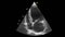 Ultrasound transesophageal examination of the heart.