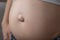 Umbilical hernia in a pregnant woman. Closeup