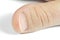 Unattractive thumb on white background