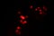 Unfocused christmas lights, hexagonal bright red bokeh