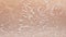 Unhealthy human skin epidermis texture with flaking and cracked