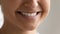 Unknown millennial lady get perfect teeth after medical whitening