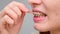 Unrecognizable Caucasian woman cleans braces with a brush. Close-up of female teeth with brackets