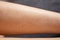 Unshaven female leg. Leg of a girl with regrown hairs