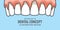 Upper Banner Periodontitis human gum inflammation illustration v