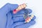 Upper denture in the hands of a dentist. blue glove. clasp prosthesis. false teeth