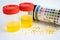 Urinalysis, urine cup with reagent strip pH paper test and comparison chart in laboratory