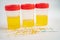 Urinalysis, urine cup with reagent strip pH paper test and comparison chart in laboratory