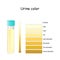 Urine Color. Chart for Assessing hydration and dehydration. Pee Color diagram